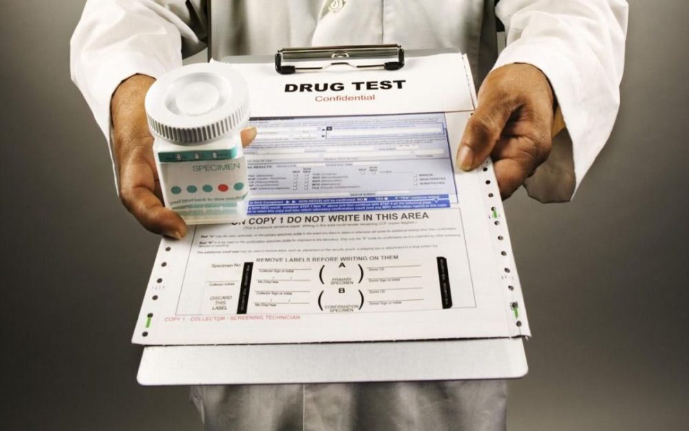 Drug Test for Job: 8 Important Things You Should Know | Complete Guide