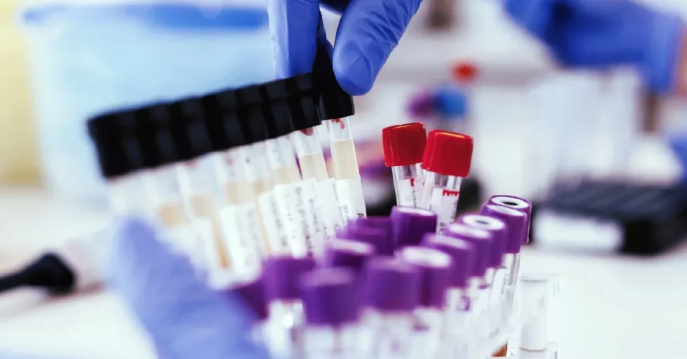 drug testing